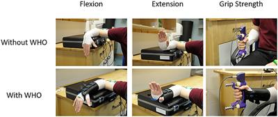 A Comparative Study of Efficacy and Functionality of Ten Commercially Available Wrist-Hand Orthoses in Healthy Females: Wrist Range of Motion and Grip Strength Analysis
